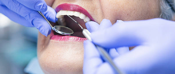 Best Emergency Dentist for Knocked-Out Tooth in Woodland, CA