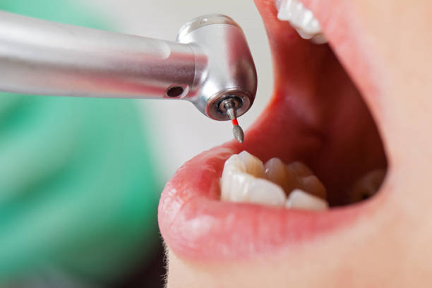 Best Emergency Dentist for Knocked-Out Tooth in Woodland, CA